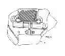 Fig. 04 - Centrifugal brake assembly