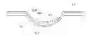 Fig. 01 - Casting cup assembly for forming an ophthalmic device