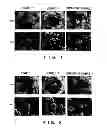 Fig. 02 - LITHIUM-RICH LITHIUM METAL COMPLEX OXIDE