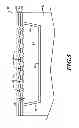 Fig. 06 - Microfluidic jetting device with piezoelectric actuator and method for making the same