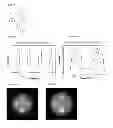 Fig. 31 - Method and apparatus of spectral differential phase-contrast cone-beam CT and hybrid cone-beam CT