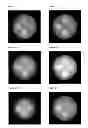Fig. 32 - Method and apparatus of spectral differential phase-contrast cone-beam CT and hybrid cone-beam CT