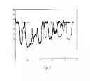 Fig. 04 - Compression and mixing for hearing assistance devices