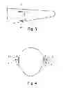 Fig. 03 - Hearing aid antenna