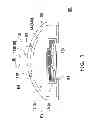 Fig. 02 - Earphone