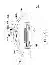 Fig. 06 - Earphone