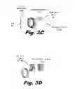 Fig. 06 - Deconvolution of digital images