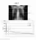Fig. 08 - Medical image processing device and medical image processing method, applying weighted penalty term in iterative approximation