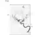 Fig. 04 - Method and device for correction of movement artifacts in a computed tomography image