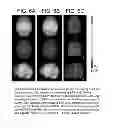 Fig. 07 - Variable-depth stereotactic surface projections
