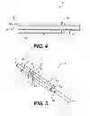 Fig. 04 - Side fire laser assembly