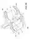 Fig. 04 - Adapter for holding a camera-bearing device to an optical instrument