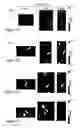 Fig. 09 - CANCER IMAGING WITH THERAPY: THERANOSTICS