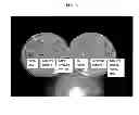 Fig. 05 - Antimicrobial Gel Formulations