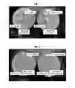Fig. 06 - Antimicrobial Gel Formulations