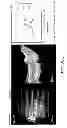 Fig. 10 - Use of omega fatty acids for treating disease