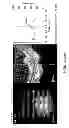 Fig. 11 - Use of omega fatty acids for treating disease