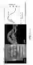 Fig. 136 - Use of omega fatty acids for treating disease