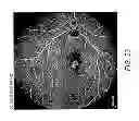 Fig. 141 - Use of omega fatty acids for treating disease