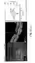 Fig. 147 - Use of omega fatty acids for treating disease