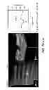 Fig. 148 - Use of omega fatty acids for treating disease