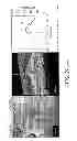 Fig. 181 - Use of omega fatty acids for treating disease
