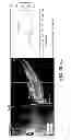 Fig. 237 - Use of omega fatty acids for treating disease