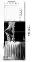 Fig. 252 - Use of omega fatty acids for treating disease