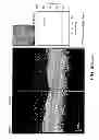 Fig. 256 - Use of omega fatty acids for treating disease