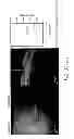 Fig. 263 - Use of omega fatty acids for treating disease