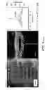 Fig. 31 - Use of omega fatty acids for treating disease