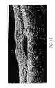 Fig. 57 - Use of omega fatty acids for treating disease