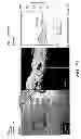 Fig. 85 - Use of omega fatty acids for treating disease