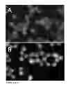 Fig. 04 - Somatic mutations in ATRX in brain cancer