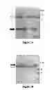 Fig. 03 - Protein complex comprising MCM8 and MCM9 proteins and their use