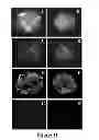 Fig. 09 - Protein complex comprising MCM8 and MCM9 proteins and their use