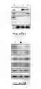 Fig. 15 - Protein complex comprising MCM8 and MCM9 proteins and their use