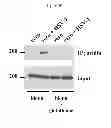 Fig. 07 - Methods of Treating Herpesvirus Infections