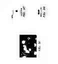Fig. 05 - METHOD FOR CONTROLLING TUMOR GROWTH, ANGIOGENESIS AND METASTASIS USING IMMUNOGLOBULIN CONTAINING AND PROLINE RICH RECEPTOR-1 (IGPR-1)