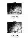 Fig. 08 - METHOD FOR CONTROLLING TUMOR GROWTH, ANGIOGENESIS AND METASTASIS USING IMMUNOGLOBULIN CONTAINING AND PROLINE RICH RECEPTOR-1 (IGPR-1)
