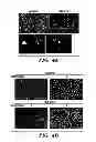 Fig. 13 - METHOD FOR CONTROLLING TUMOR GROWTH, ANGIOGENESIS AND METASTASIS USING IMMUNOGLOBULIN CONTAINING AND PROLINE RICH RECEPTOR-1 (IGPR-1)