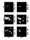 Fig. 18 - METHOD FOR CONTROLLING TUMOR GROWTH, ANGIOGENESIS AND METASTASIS USING IMMUNOGLOBULIN CONTAINING AND PROLINE RICH RECEPTOR-1 (IGPR-1)