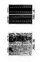 Fig. 20 - METHOD FOR CONTROLLING TUMOR GROWTH, ANGIOGENESIS AND METASTASIS USING IMMUNOGLOBULIN CONTAINING AND PROLINE RICH RECEPTOR-1 (IGPR-1)