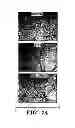 Fig. 24 - METHOD FOR CONTROLLING TUMOR GROWTH, ANGIOGENESIS AND METASTASIS USING IMMUNOGLOBULIN CONTAINING AND PROLINE RICH RECEPTOR-1 (IGPR-1)
