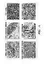 Fig. 35 - METHOD FOR CONTROLLING TUMOR GROWTH, ANGIOGENESIS AND METASTASIS USING IMMUNOGLOBULIN CONTAINING AND PROLINE RICH RECEPTOR-1 (IGPR-1)