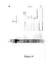 Fig. 07 - Use of an IL12 receptor-beta 1 splice variant to diagnose active tuberculosis