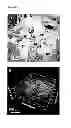 Fig. 08 - Injectable cryogel vaccine devices and methods of use thereof