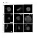 Fig. 41 - Injectable cryogel vaccine devices and methods of use thereof