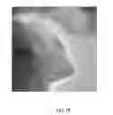 Fig. 26 - COMPOSITIONS AND METHODS FOR THE PREVENTION AND TREATMENT OF METABOLIC DISEASES