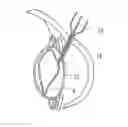 Fig. 01 - ACCOMMODATING INTRAOCULAR LENS